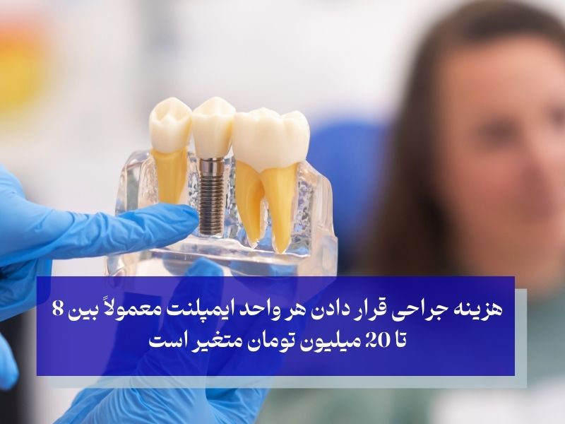 هزینه جراحی قرار دادن ایمپلنت؛ کاشت پایه‌های استوار