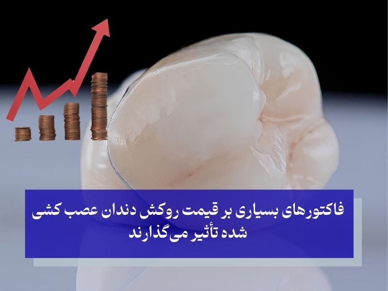 هزینه عصب کشی و روکش دندان