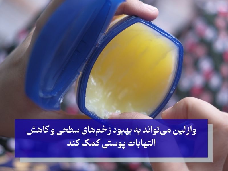 وازلین چیست و چگونه عمل می‌کند؟