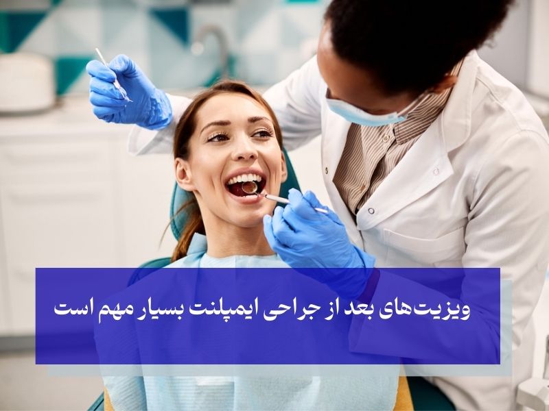 ویزیت‌های بعد از جراحی ایمپلنت