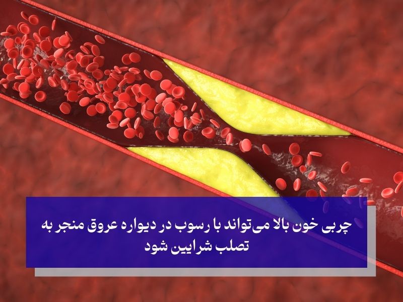 چربی خون چیست و چرا اهمیت دارد؟