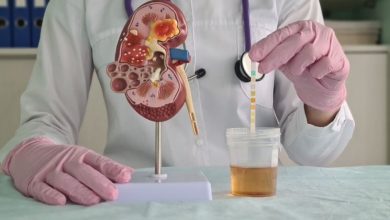 چه چیزی برای رفع دفع پروتئین کلیه خوب است