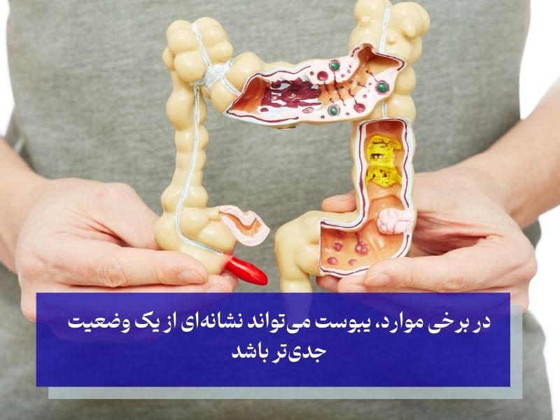 یبوست؛ علل و علائم عمومی