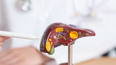 درمان کبد چرب گرید 2