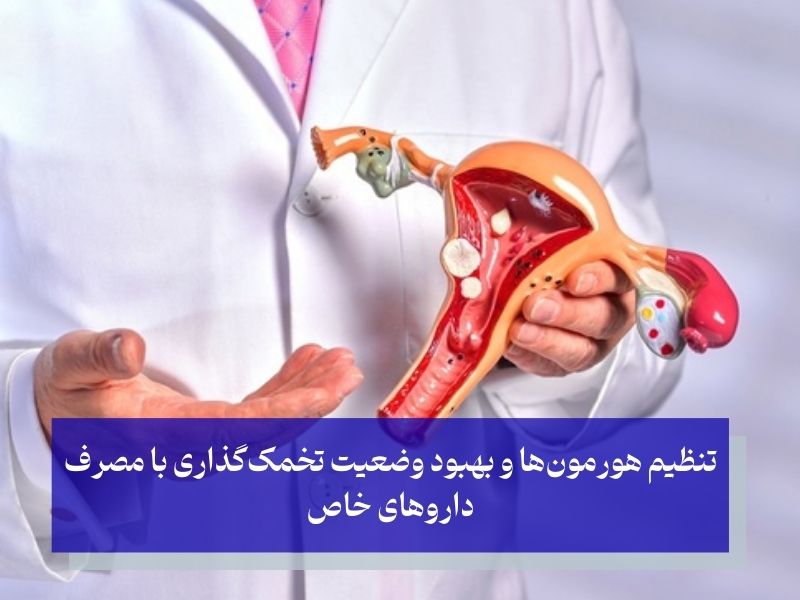 بهترین داروهای شیمیایی برای تنبلی تخمدان 