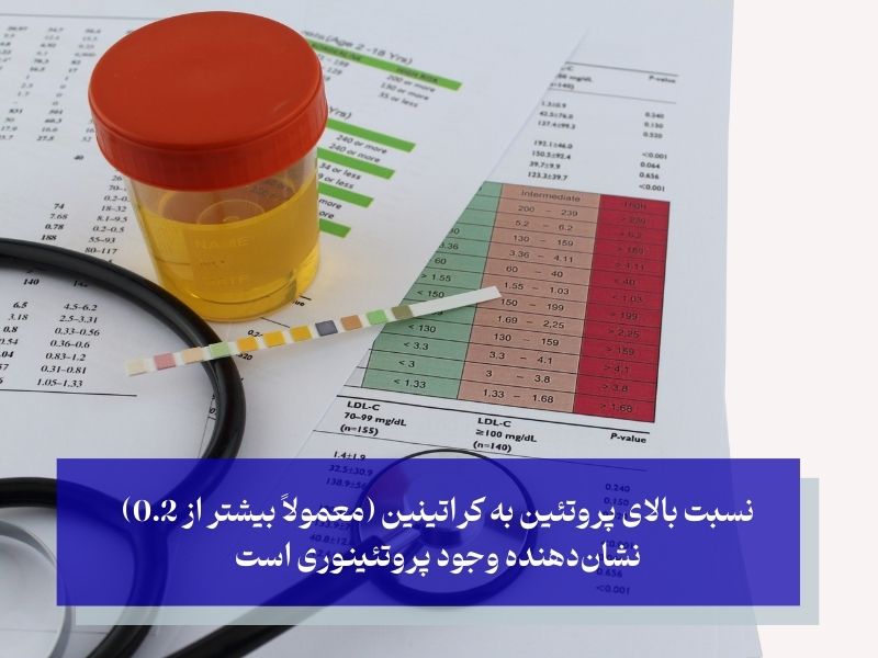 آزمایش نسبت پروتئین به کراتینین در ادرار