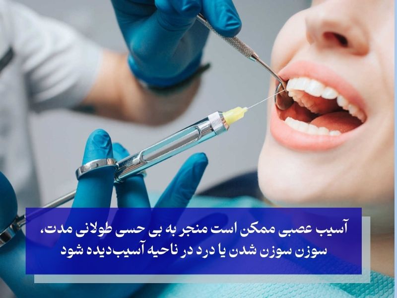 آسیب عصبی در عوارض جانبی بی حسی دندان