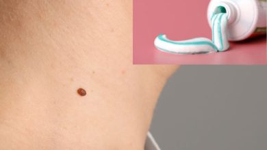 از بین بردن خال گوشتی با خمیر دندان