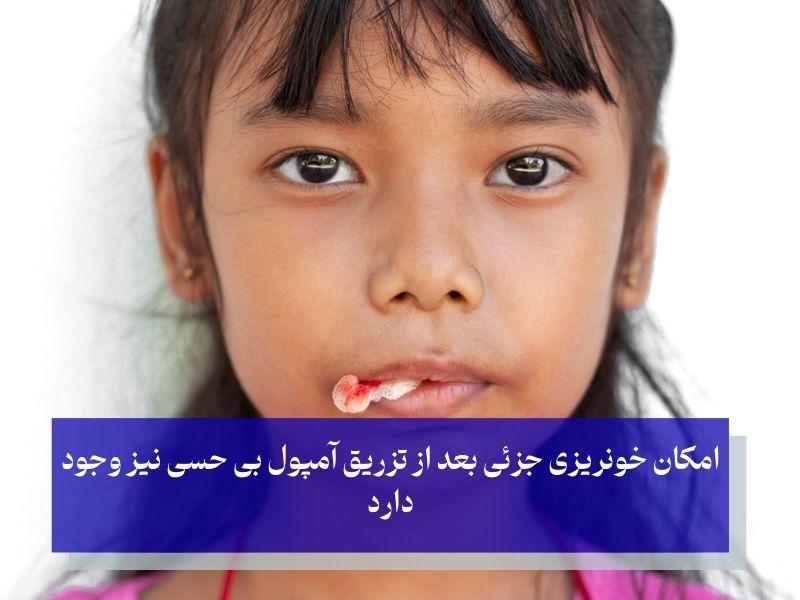 خونریزی جزئی