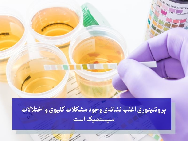 دفع پروتئین چیست؟  اهمیت توجه جدی به دفع پروتئین