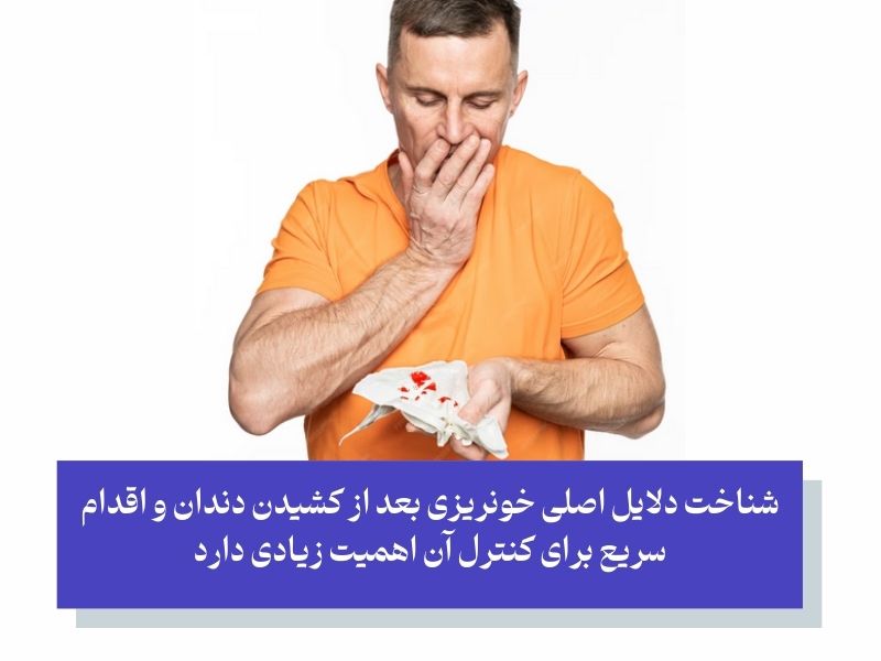 دلیل بند نیامدن خون بعد از کشیدن دندان چیست