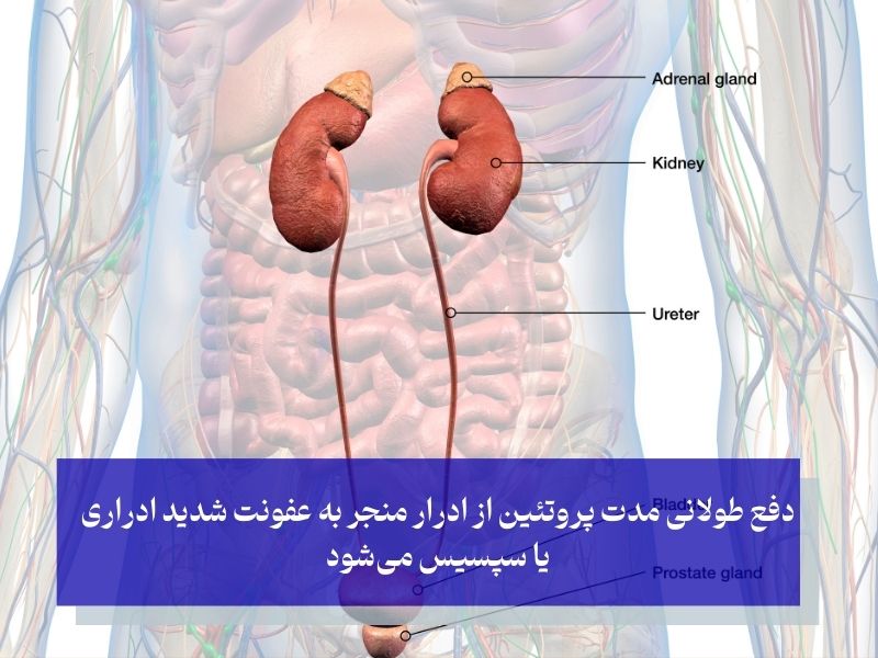 عوارض خطرناک و اورژانسی پروتئینوری