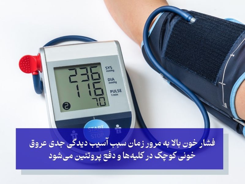 فشار خون بالا؛ عامل مهم آسیب به عروق خونی کلیه