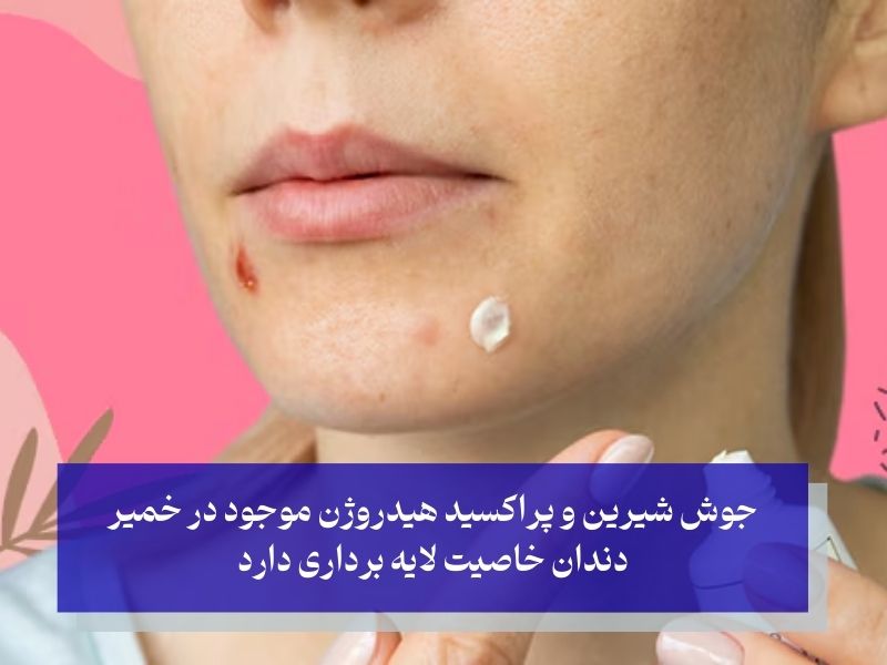 لایه‌برداری خمیر دندان