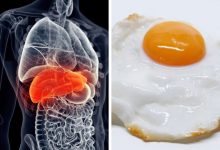 مضرات سفیده تخم مرغ برای کبد