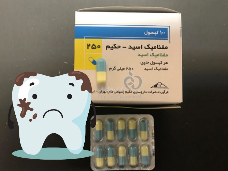 نحوه مصرف مفنامیک اسید برای دندان درد