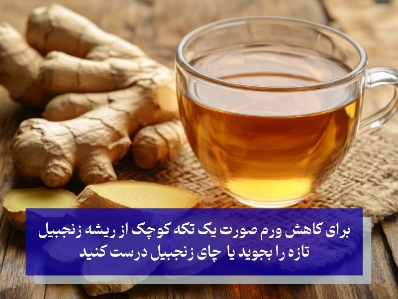 کاهش ورم صورت با زنجبیل