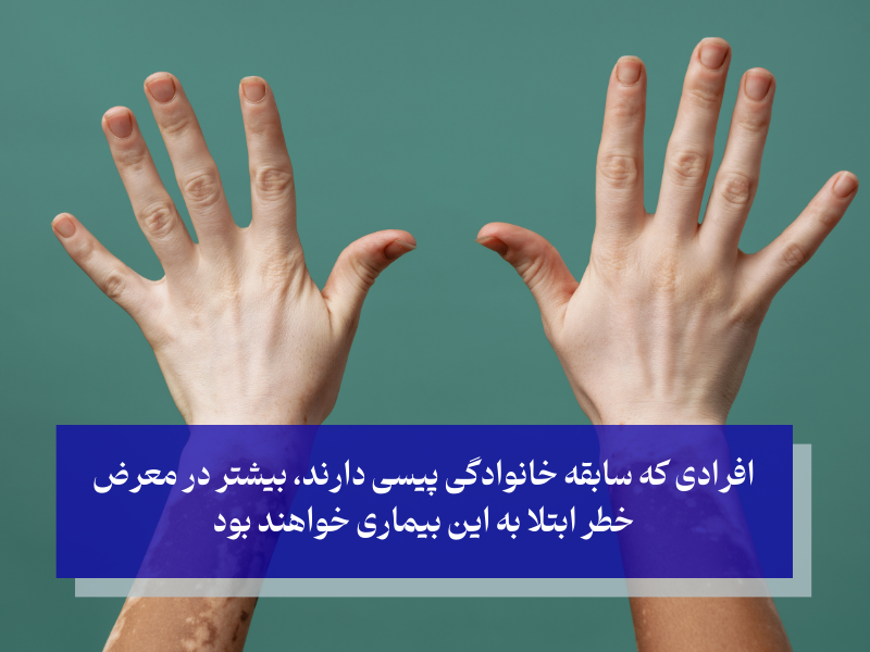 ژنتیک (وراثت)؛ مهمترین عامل ابتلا به بیماری پیسی