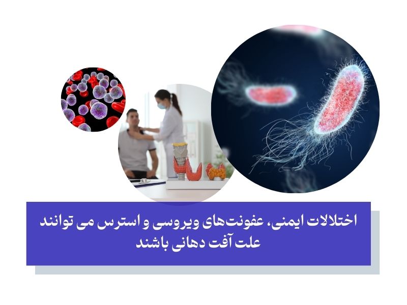 علت بروز آفت دهان