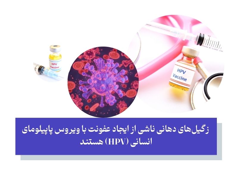 علت بروز زگیل دهانی ویروس