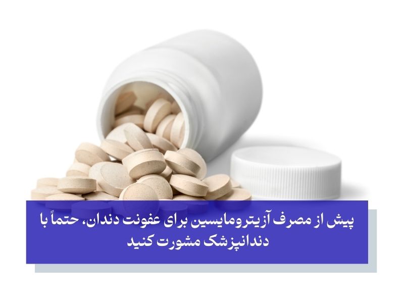 نحوه مصرف آزیترومایسین برای عفونت دندان