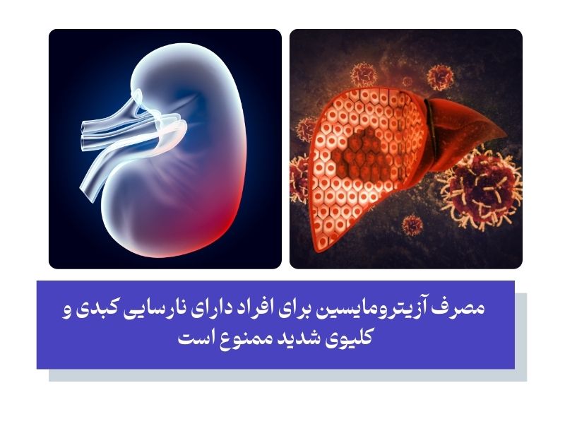 موارد منع مصرف آزیترومایسین