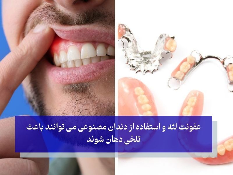 تلخی دهان و ارتباط آن با مشکلات دهان و دندان