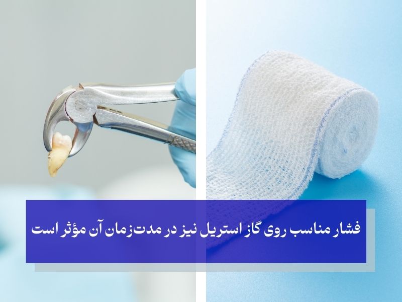 زمان برداشتن گاز استریل 