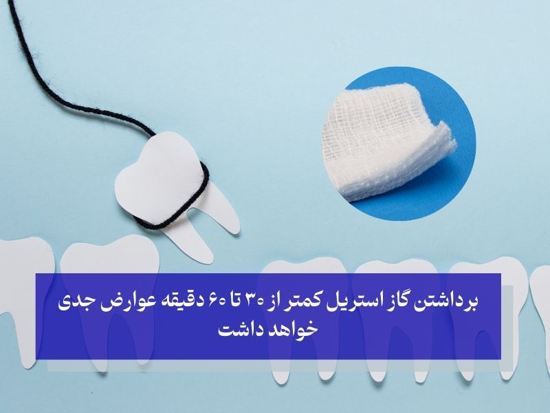 برداشتن گاز استریل کمتر از ۳۰ تا ۶۰ دقیقه