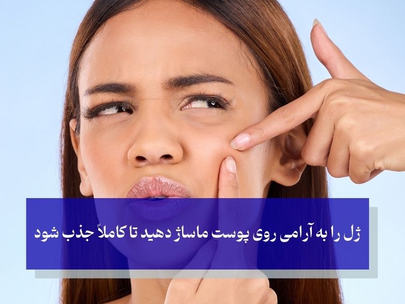 ژل آلوورا برای پوست های مستعد آکنه