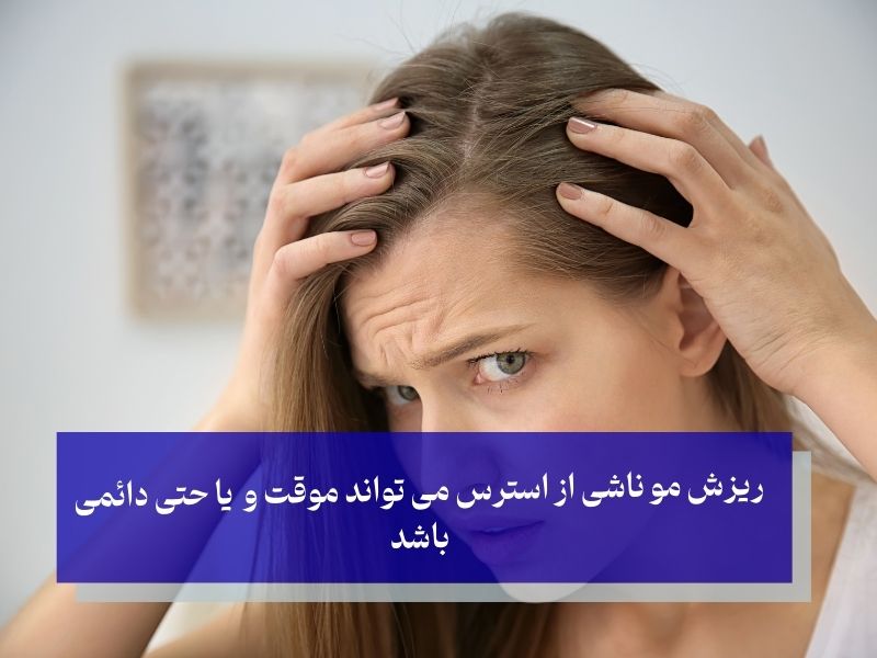 انواع ریزش موی ناشی از استرس