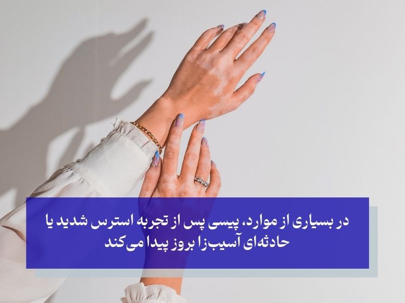 استرس روانی؛ علت لکههای سفید روی پوست