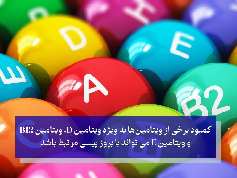 کمبود ویتامین؛ موثر در ابتلا به پیسی