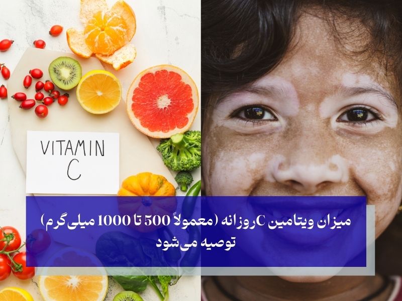 مصرف ویتامین C برای بیماران مبتلا به پیسی