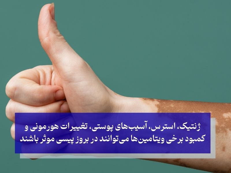 کمبود چه ویتامینی در بدن باعث پیسی میشود