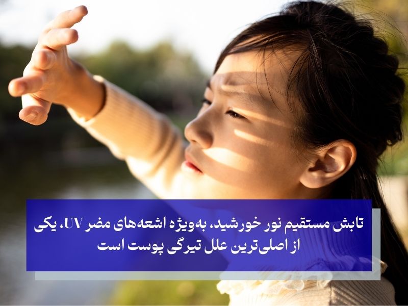 تیرگی پوست با تابش نور