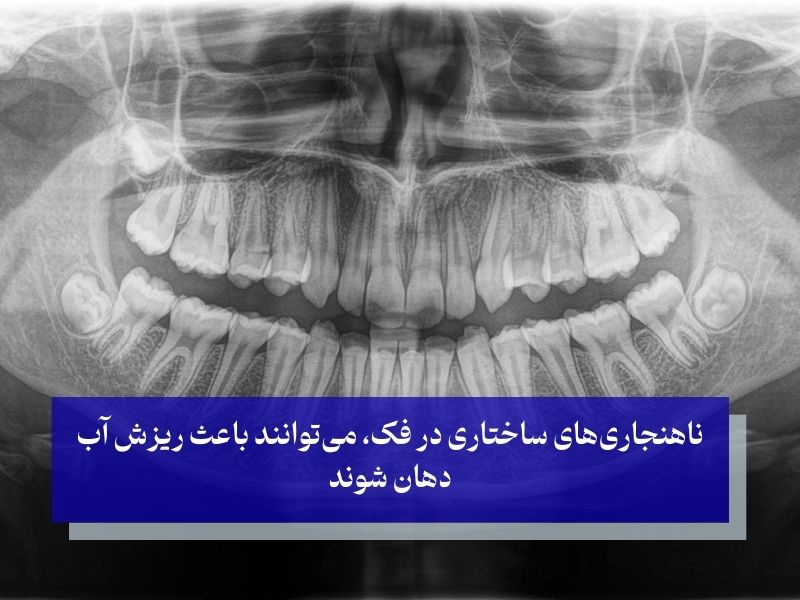 مشکلات در ساختار فک و دهان