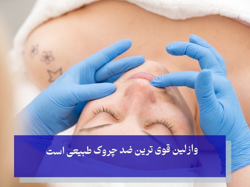 وازلین قوی‌ترین ضد چروک طبیعی است.