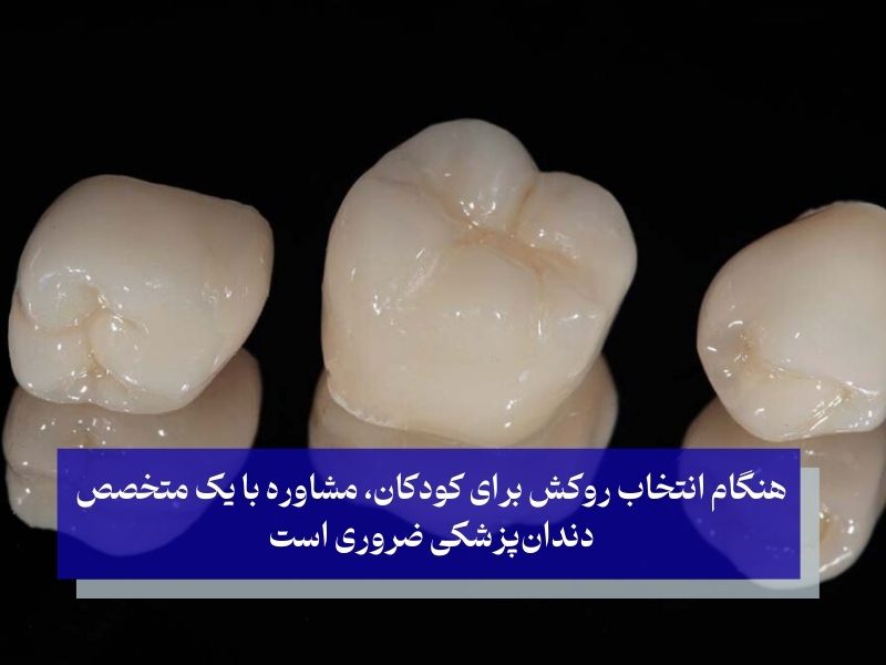 انواع روکش‌های دندانی برای کودکان