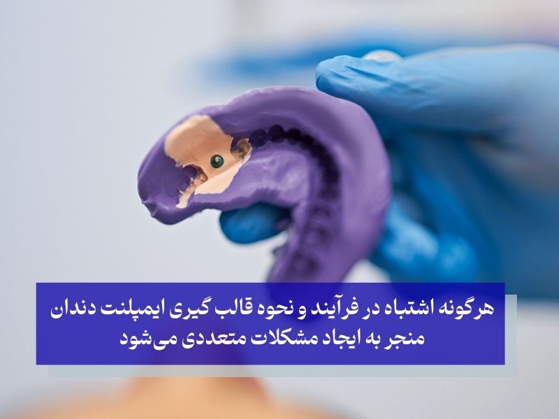 اهمیت دقت در نحوه قالب گیری ایمپلنت