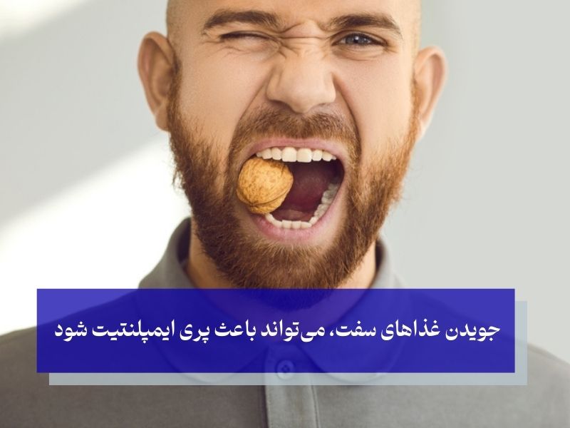 بارگذاری بیش از حد