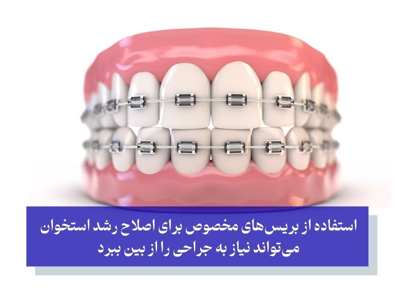 جلوگیری از جراحی ارتوسرجری