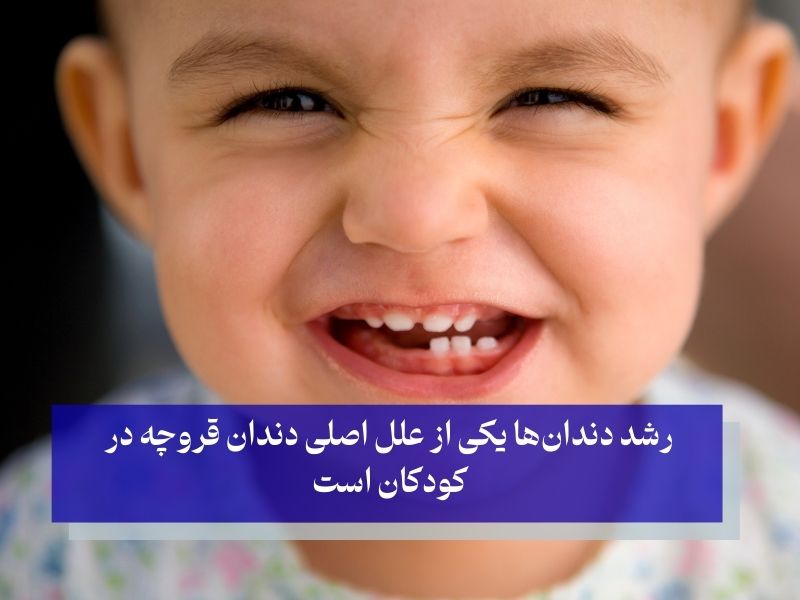 رشد دندان‌ها و دندان قروچه؛ فشار زیاد روی فک و دندان قروچه