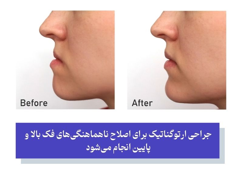 ضرورت انجام ارتوسرجری چیست؟