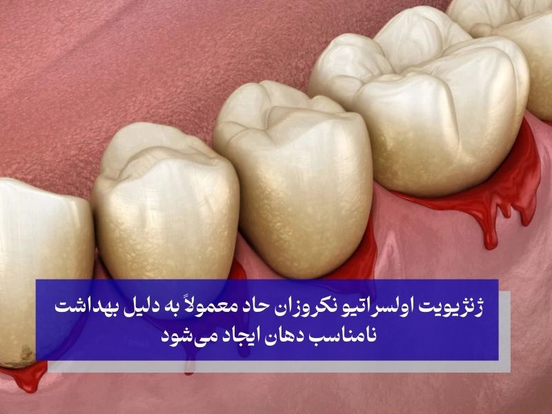 علت سیاه شدن لثه و درد