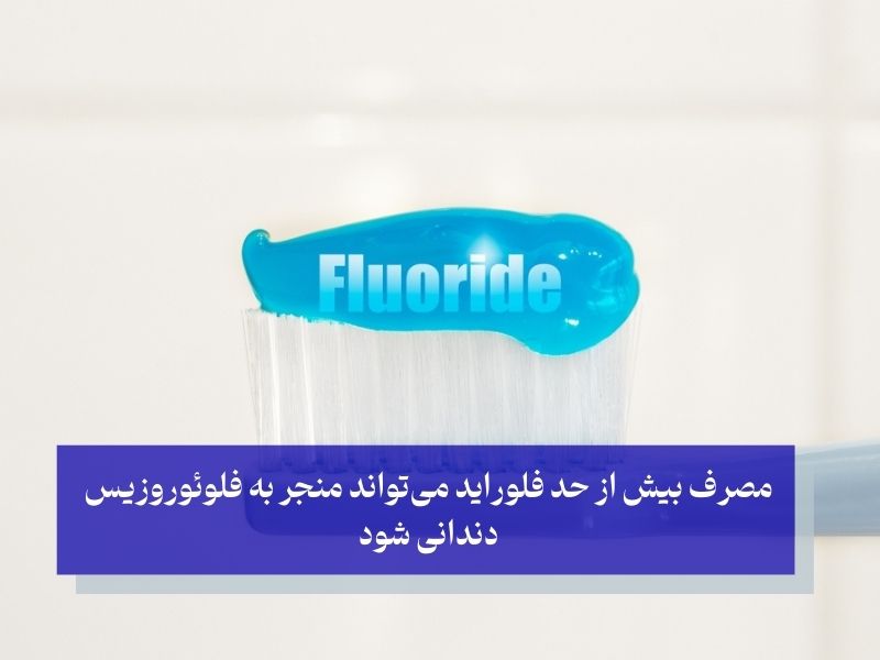 فلوراید در خمیردندان