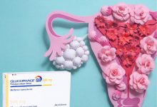 قرص گلوکوفاژ برای تنبلی تخمدان