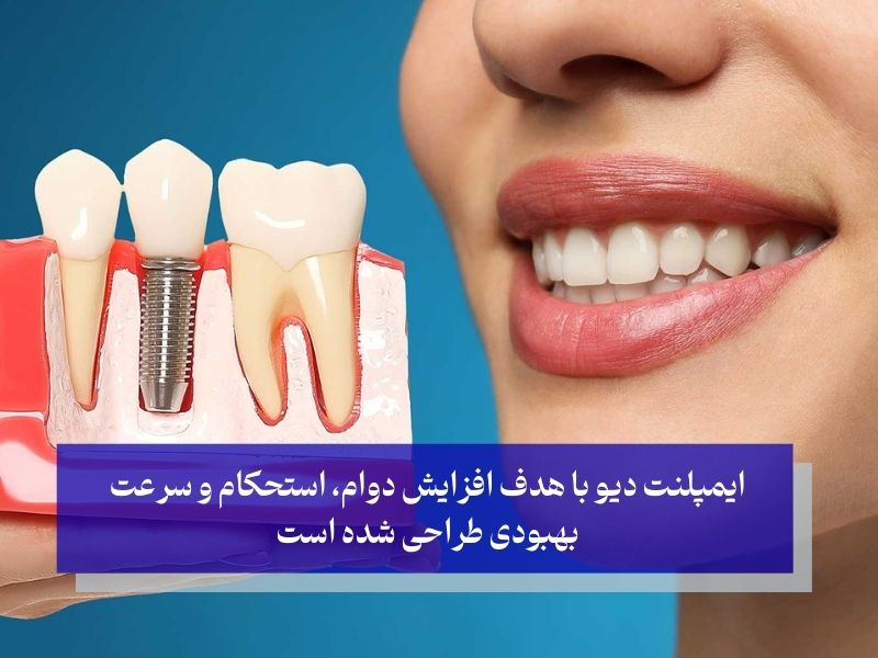 مشخصات ایمپلنت dio