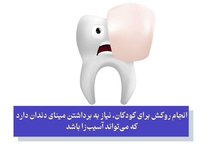 معایب روکش‌های دندانی برای کودکان