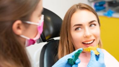 نحوه قالب گیری ایمپلنت